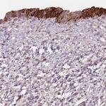 TMEM80 Polyclonal Antibody