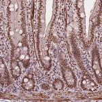 GTF3C5 Antibody in Immunohistochemistry (Paraffin) (IHC (P))