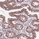 FAM46A Antibody in Immunohistochemistry (Paraffin) (IHC (P))