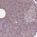 FAM46A Polyclonal Antibody