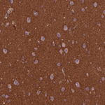 FAM46A Antibody in Immunohistochemistry (Paraffin) (IHC (P))