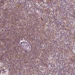 ADAM33 Polyclonal Antibody