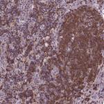 ACAD10 Polyclonal Antibody