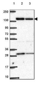 ACAD10 Antibody in Western Blot (WB)