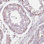 TAF6L Antibody in Immunohistochemistry (Paraffin) (IHC (P))