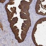 UMODL1 Antibody in Immunohistochemistry (Paraffin) (IHC (P))