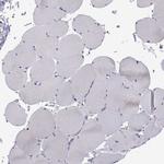 UMODL1 Antibody in Immunohistochemistry (Paraffin) (IHC (P))