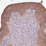 HAUS5 Polyclonal Antibody