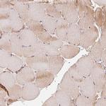 COQ7 Polyclonal Antibody