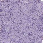 AMOT Antibody in Immunohistochemistry (Paraffin) (IHC (P))