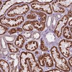 C18orf21 Polyclonal Antibody