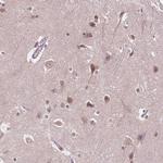 ISLR2 Polyclonal Antibody