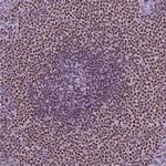 SP140 Antibody in Immunohistochemistry (Paraffin) (IHC (P))