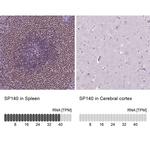 SP140 Antibody in Immunohistochemistry (IHC)
