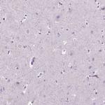 SP140 Antibody in Immunohistochemistry (IHC)