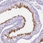 KLHL10 Polyclonal Antibody