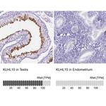 KLHL10 Antibody in Immunohistochemistry (IHC)