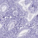KLHL10 Antibody in Immunohistochemistry (IHC)