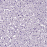 GABRB2 Polyclonal Antibody