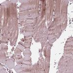 BTBD1 Antibody in Immunohistochemistry (IHC)