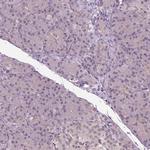 BTBD1 Antibody in Immunohistochemistry (IHC)