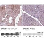 BTBD1 Antibody