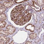 CYYR1 Antibody in Immunohistochemistry (Paraffin) (IHC (P))