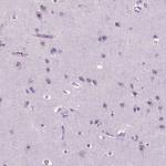 ZNF853 Antibody in Immunohistochemistry (Paraffin) (IHC (P))