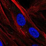 SBSN Polyclonal Antibody