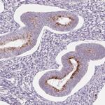 SAMD5 Antibody in Immunohistochemistry (Paraffin) (IHC (P))