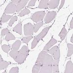 SAMD5 Antibody in Immunohistochemistry (Paraffin) (IHC (P))