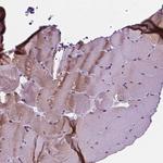 FAM50B Antibody in Immunohistochemistry (Paraffin) (IHC (P))