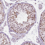 FAM50B Antibody in Immunohistochemistry (Paraffin) (IHC (P))