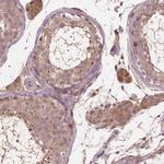 GJA9 Polyclonal Antibody