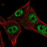 POLR3D Polyclonal Antibody