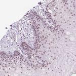 POLR3D Antibody in Immunohistochemistry (Paraffin) (IHC (P))