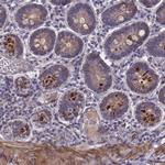 FBXW2 Antibody in Immunohistochemistry (Paraffin) (IHC (P))
