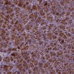 AP5B1 Antibody in Immunohistochemistry (Paraffin) (IHC (P))