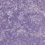 MYH14 Polyclonal Antibody