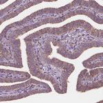 Gemin 4 Polyclonal Antibody