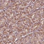 CDKL4 Polyclonal Antibody