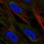 CCDC71L Polyclonal Antibody