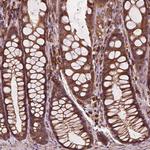 CCDC71L Antibody in Immunohistochemistry (Paraffin) (IHC (P))