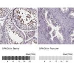 SPAG8 Antibody in Immunohistochemistry (IHC)