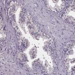 SPAG8 Antibody in Immunohistochemistry (IHC)