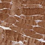 MROH6 Antibody in Immunohistochemistry (IHC)