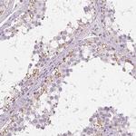C19orf84 Polyclonal Antibody