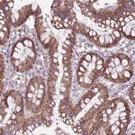 THEGL Polyclonal Antibody