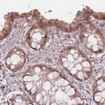 FNIP1 Polyclonal Antibody