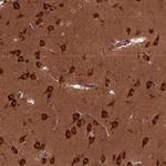 CYFIP1 Polyclonal Antibody